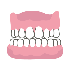 入れ歯トラブル (2)